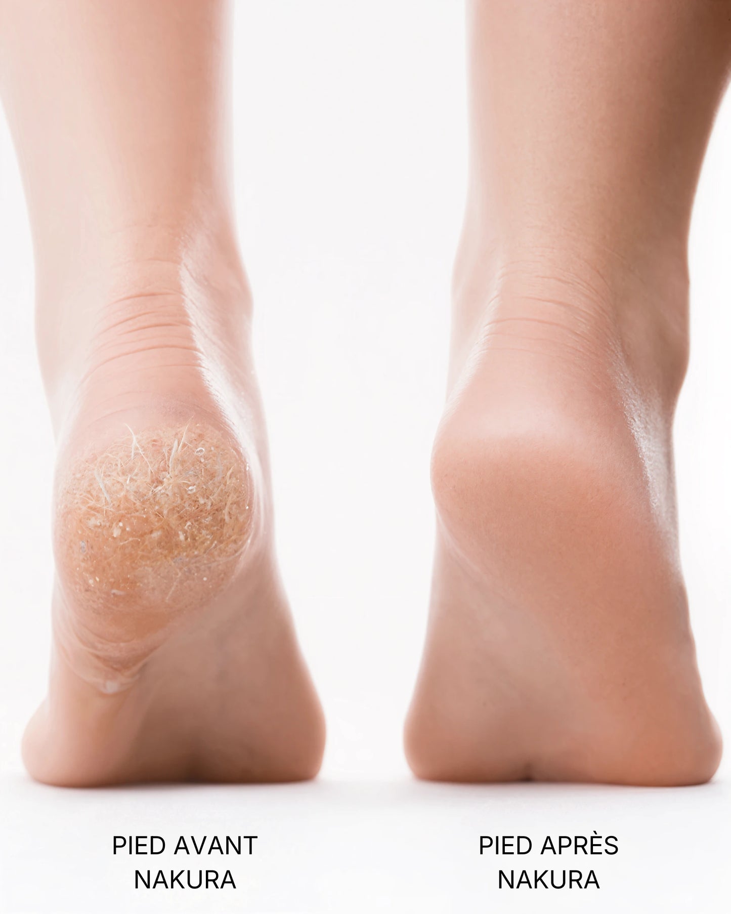 Nakura SoftSkin Pro™