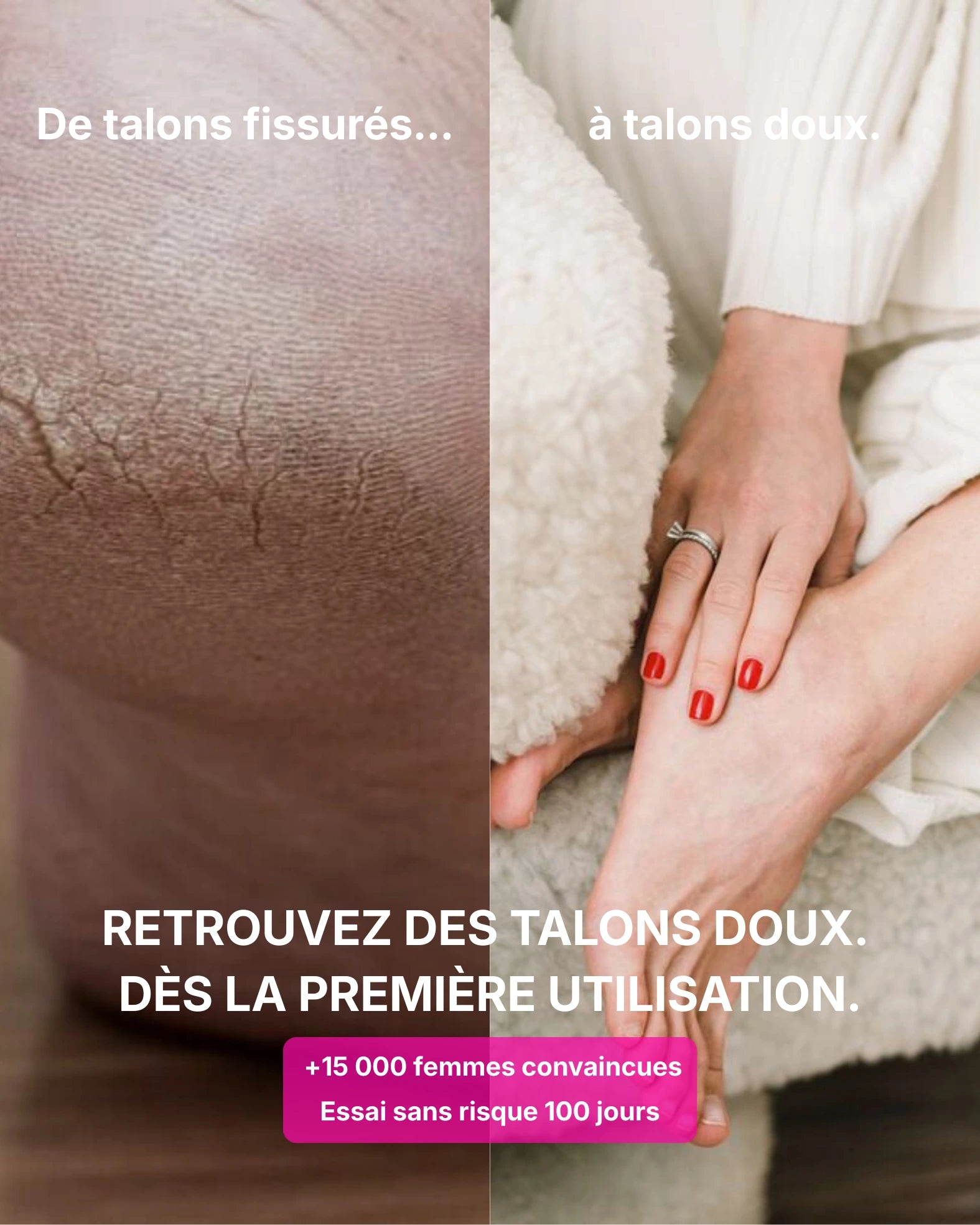 Nakura SoftSkin Pro™